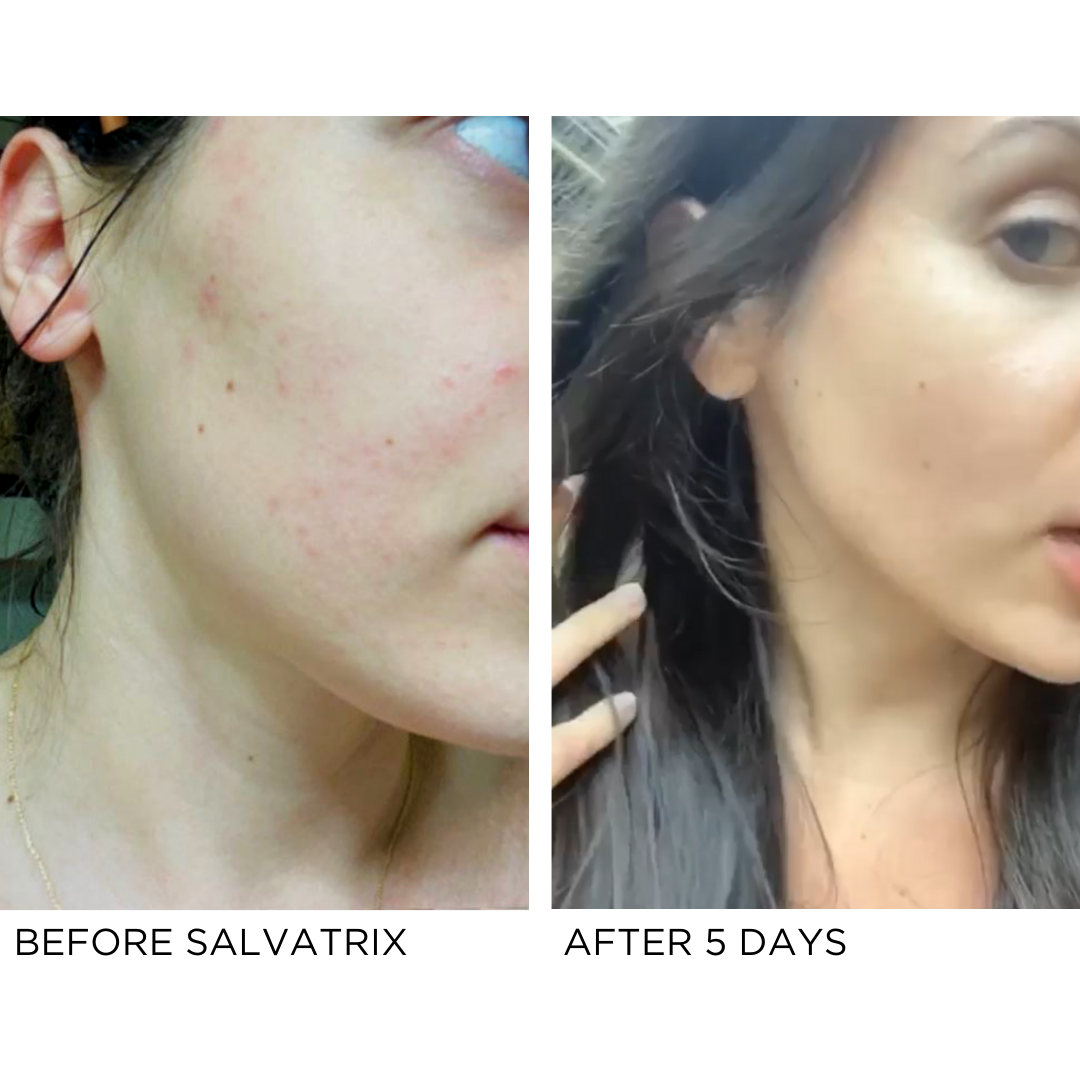Salvatrix | Anti-Blemish Serum